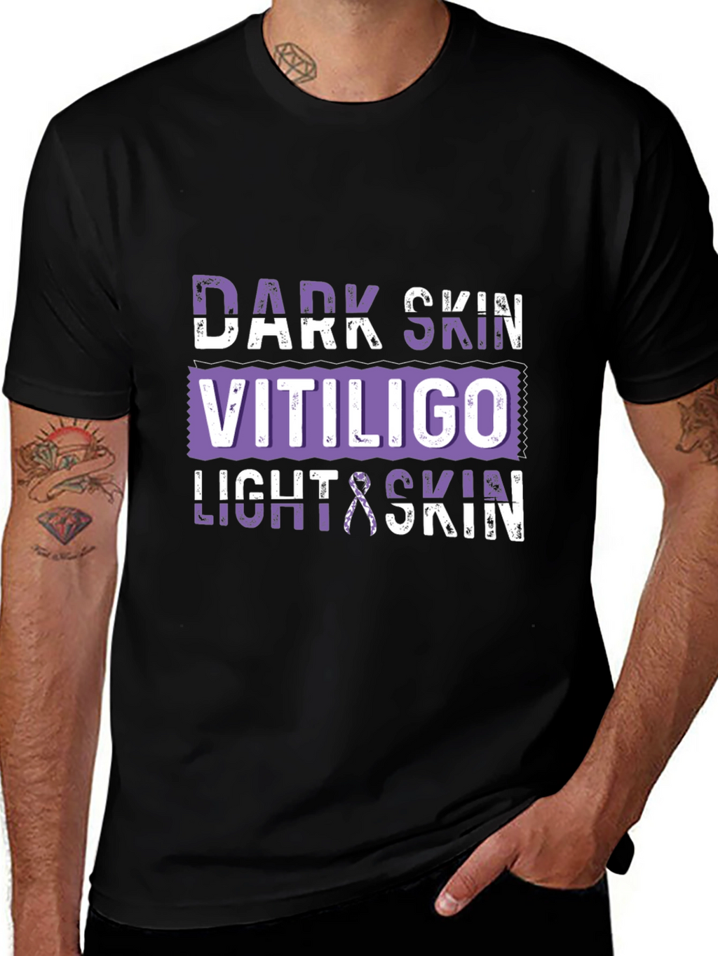 Vitiligo Awareness T-Shirt