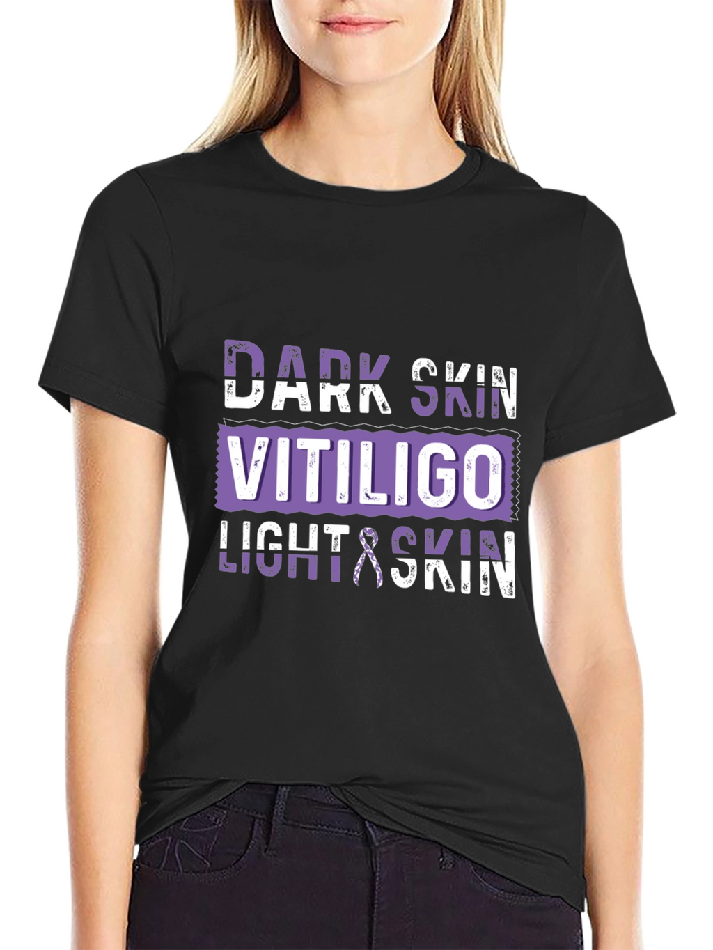 Vitiligo Awareness T-Shirt