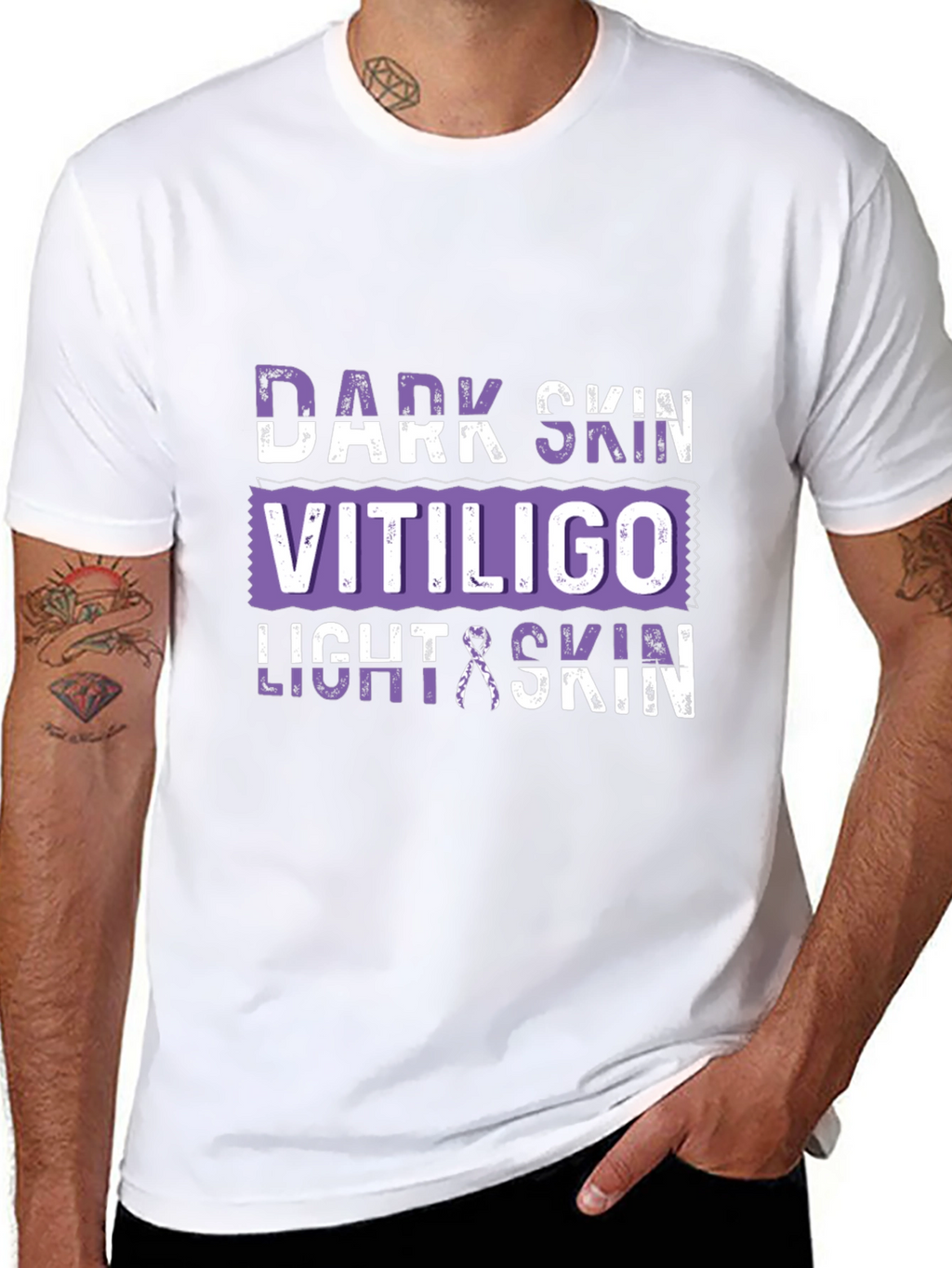 Vitiligo Awareness T-Shirt