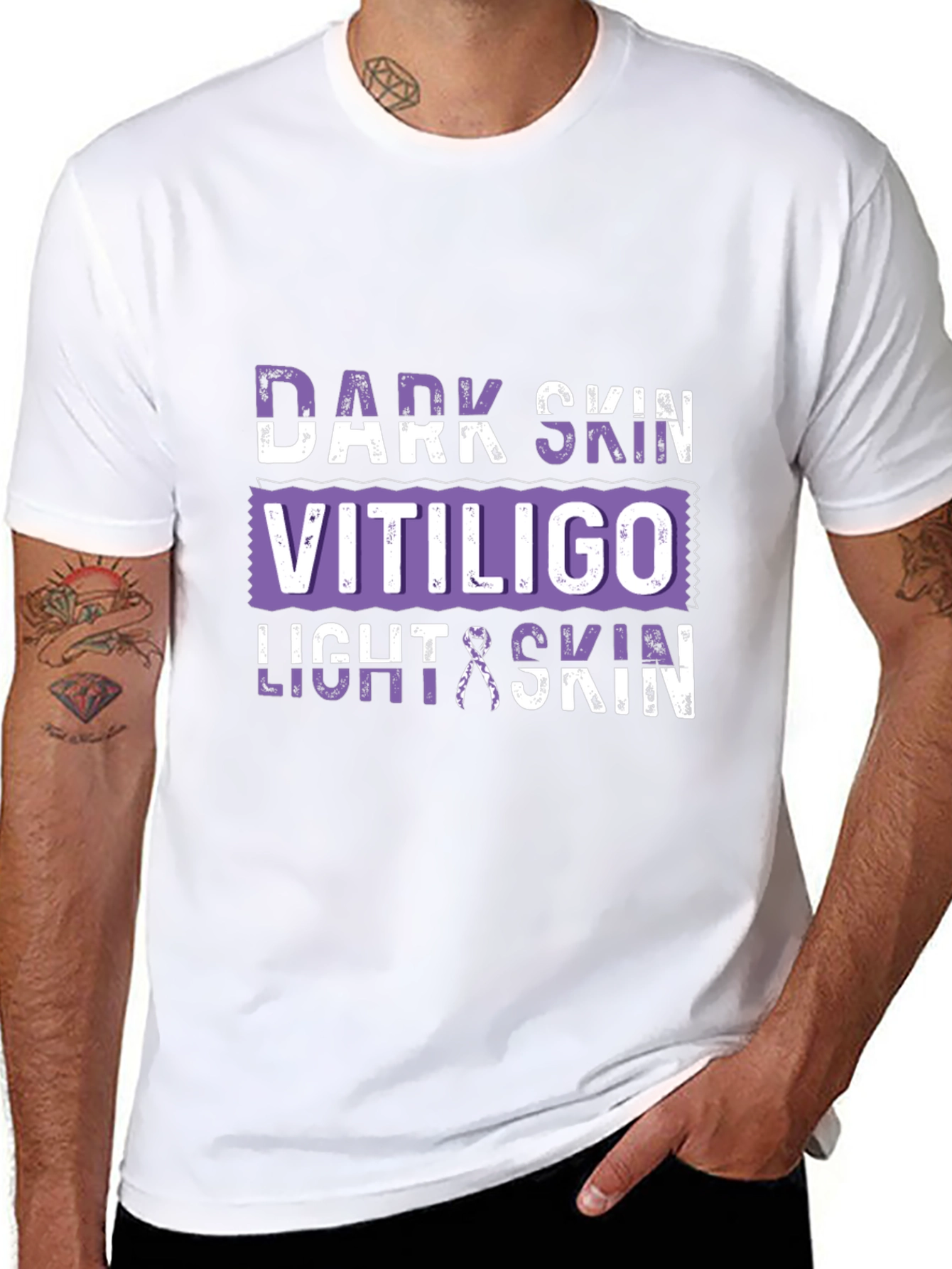 Vitiligo Awareness T-Shirt