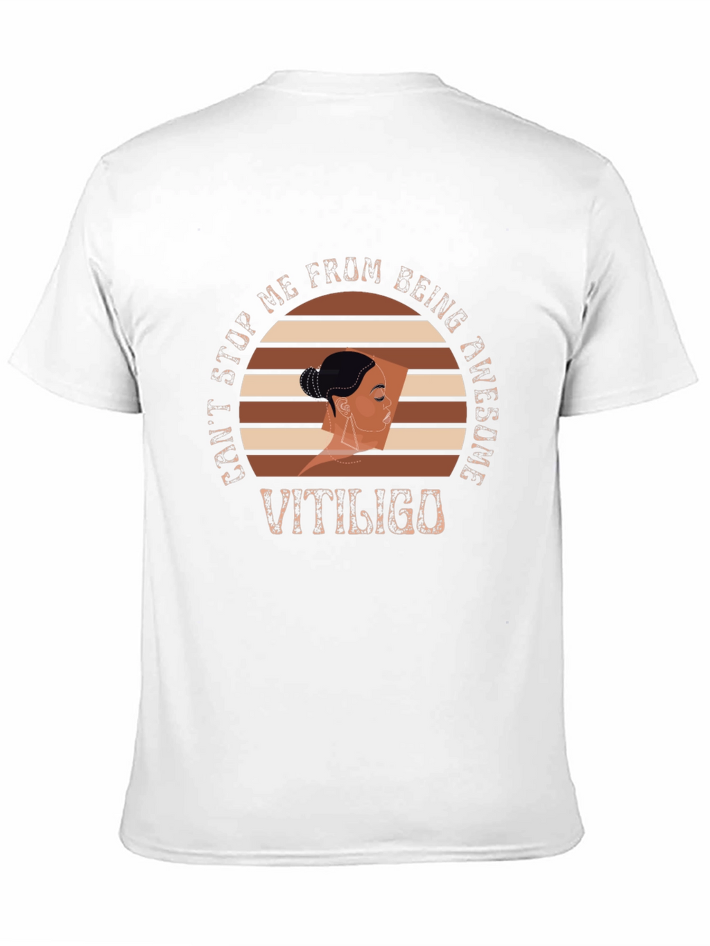 Vitiligo Awesome Graphic T-Shirt