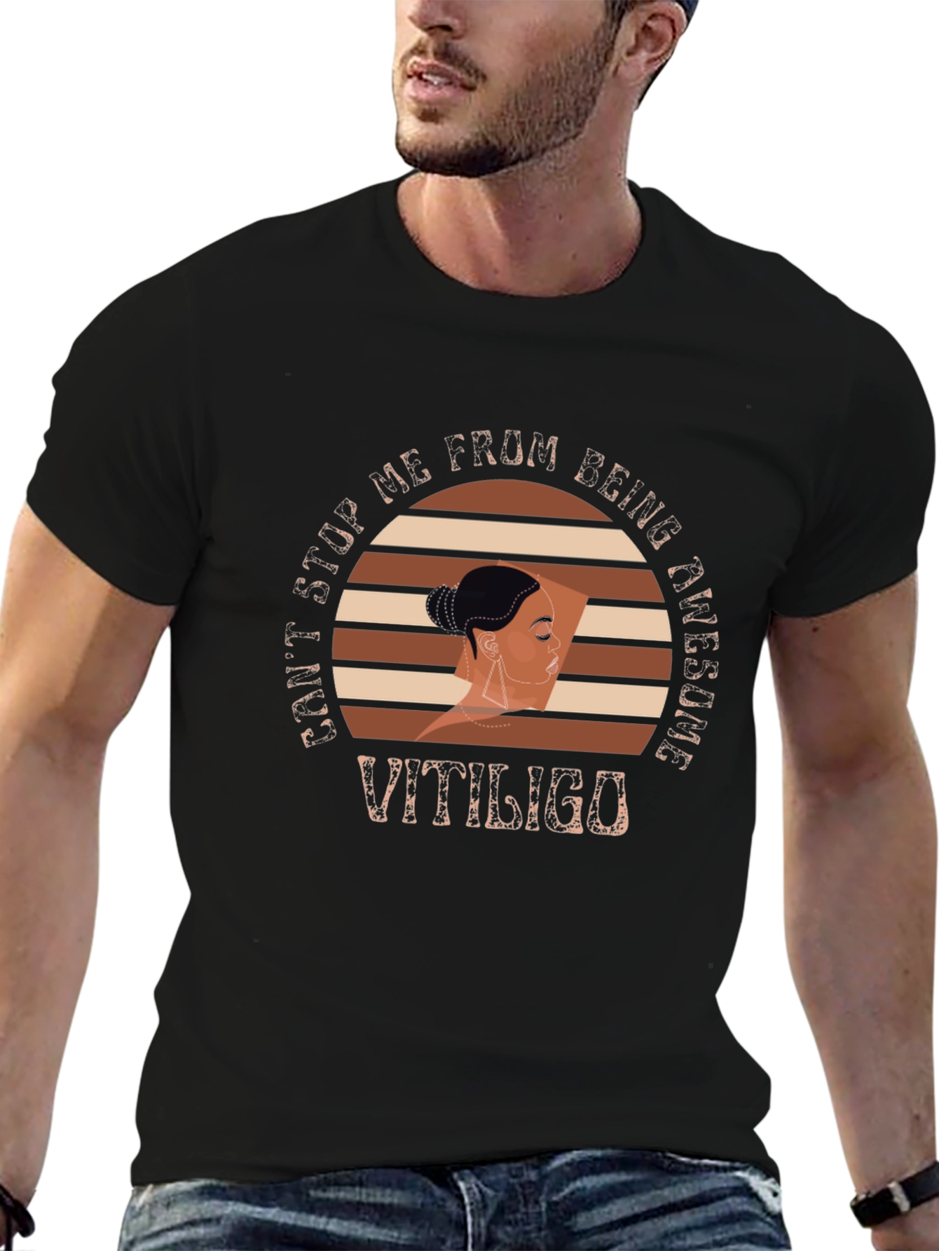 Vitiligo Awesome Graphic T-Shirt