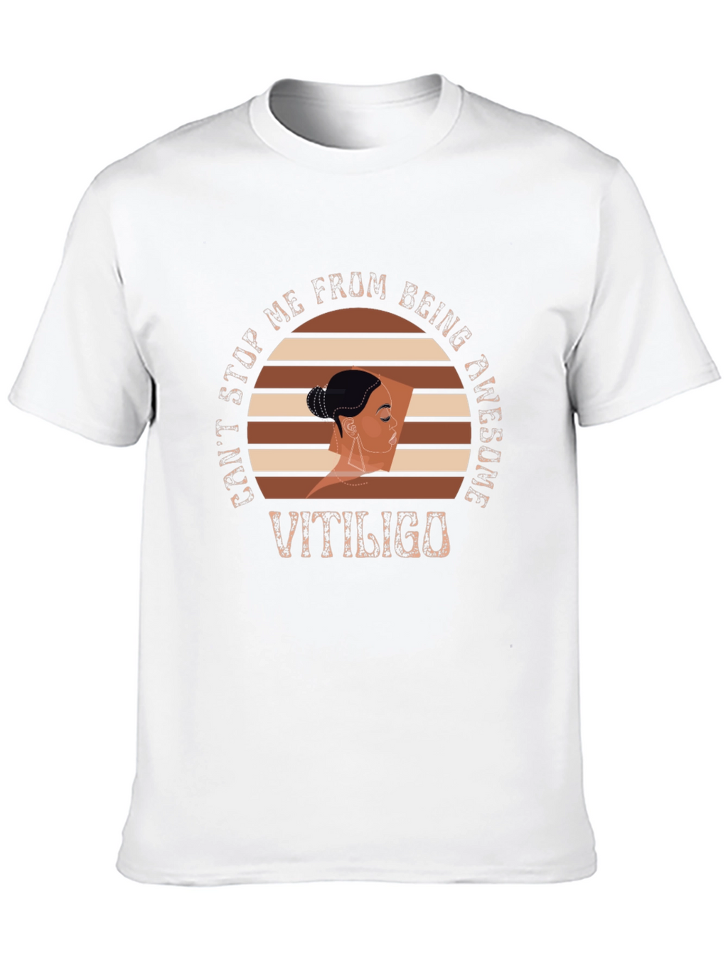 Vitiligo Awesome Graphic T-Shirt