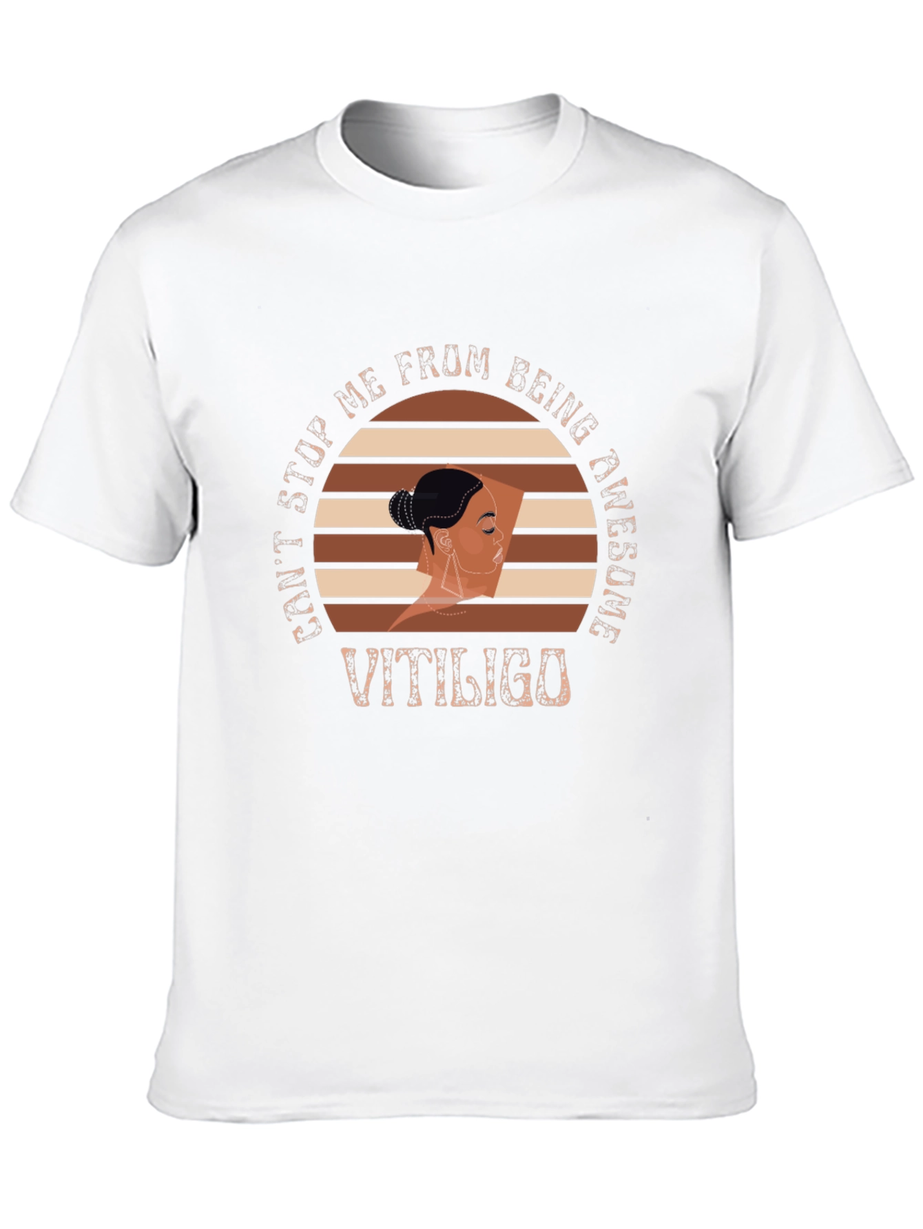 Vitiligo Awesome Graphic T-Shirt